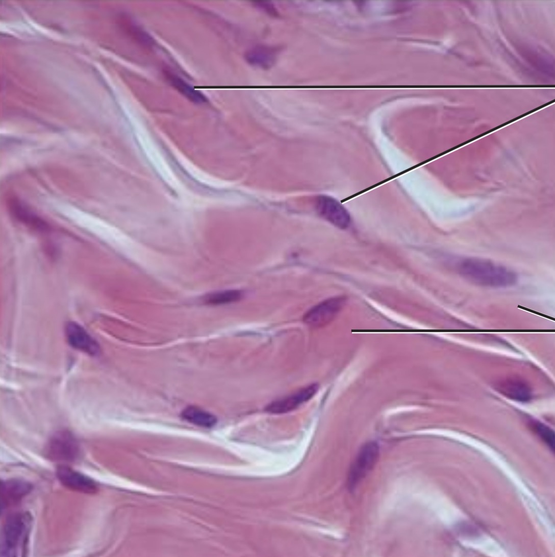 <p>Dermis of the skin</p>