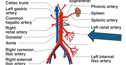 <p>littler tree </p>