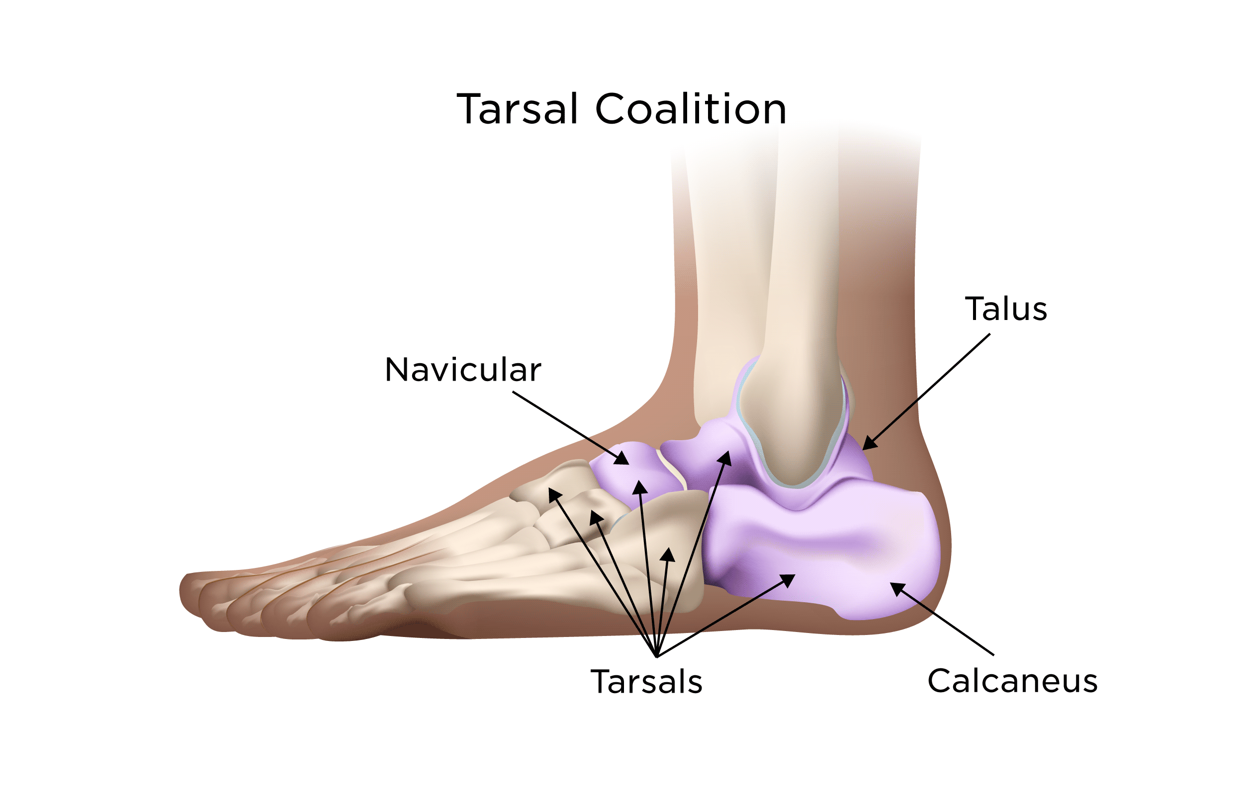<p>the ankle bones</p>