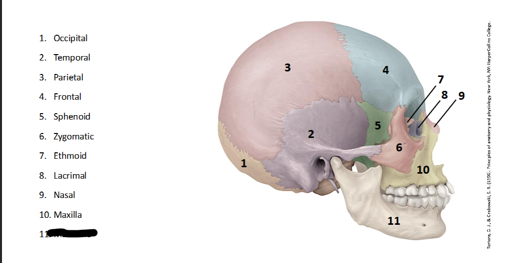 <p>What landmark within the <strong>Skull? (LATERAL)</strong></p>