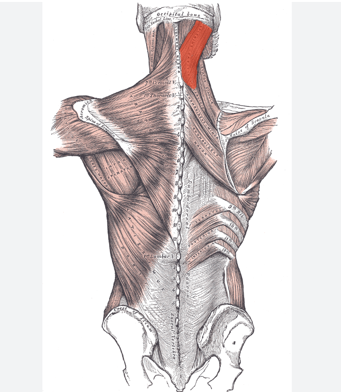 <p>Identify the highlighted muscle </p>