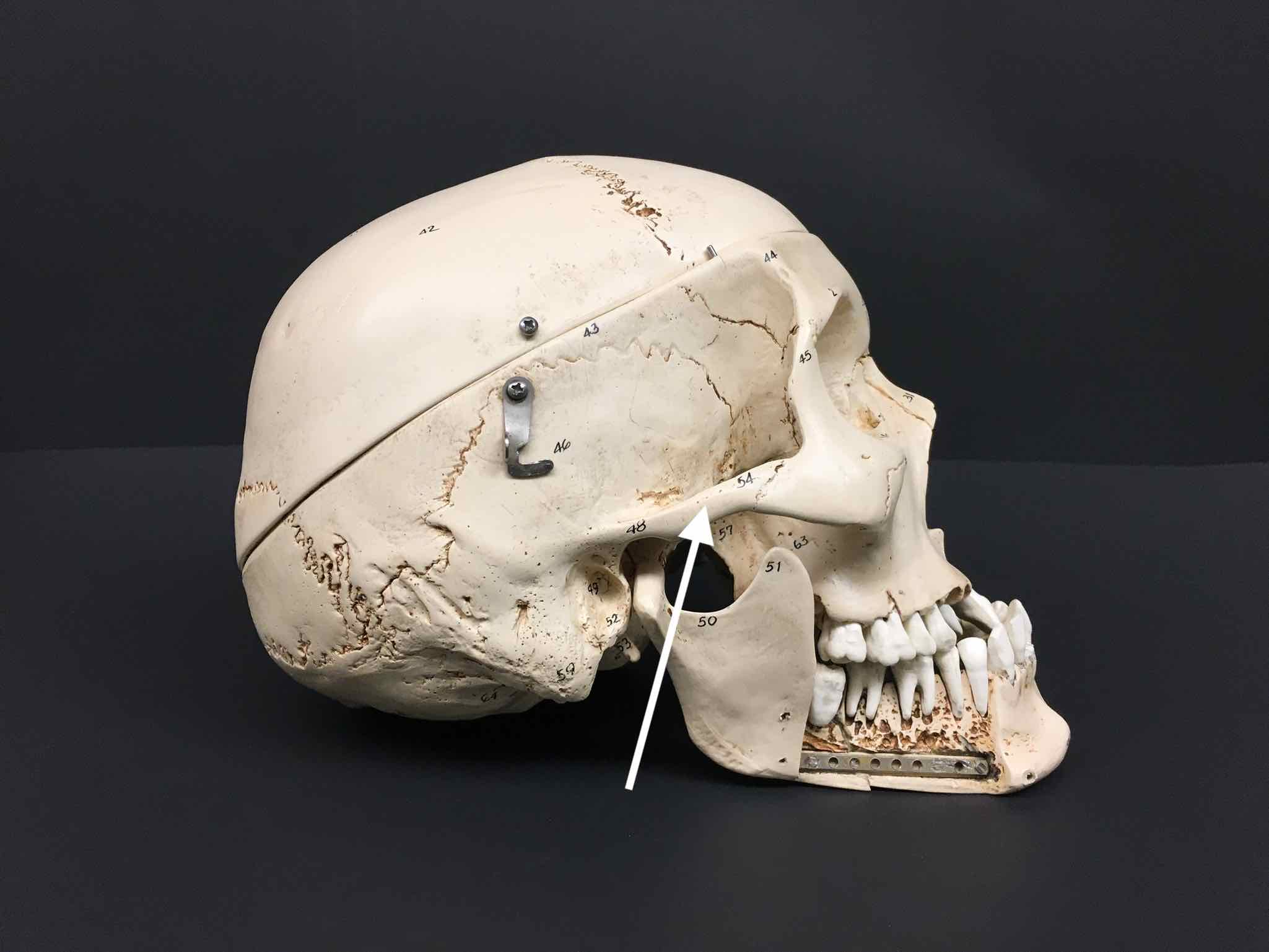<p>A projection of the temporal bone that extends anteriorly and articulates with the zygomatic bone. Clue: temporal → zygomatic.</p>