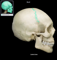 <p>A functional joint classification describing an immovable joint.</p>
