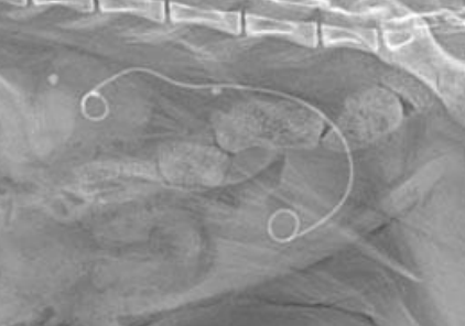 <p>A ureteral what device is made of a special polymer and remains stiff at room temperature to facilitate placement but softens at body temperature for long term comfort? It is radiopaque and hydrophilic, has multiple fenestrations, requires GA, dorsal recumbency, and endoscopic placement, and uses contrast to place/monitor/ensure placement. In females it can be placed endoscopically, but male cats require surgery (antegrade or retrograde). Antegrade access is most often performed. These are used to help treat ureteral lithiasis, but are often accompanied by morbidity, pain, infection, and irritative voiding symptoms.</p>