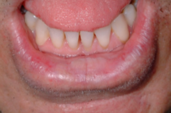 <p>what is this condition</p>