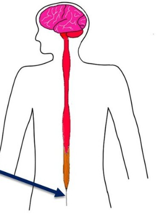 <p><br><span>a ~20 cm long, delicate connective tissue strand extending from the conus medullaris (end of the spinal cord) to the coccyx, acting as a stabilizer that anchors the spinal cord. Produced by the Pia mater. </span></p>