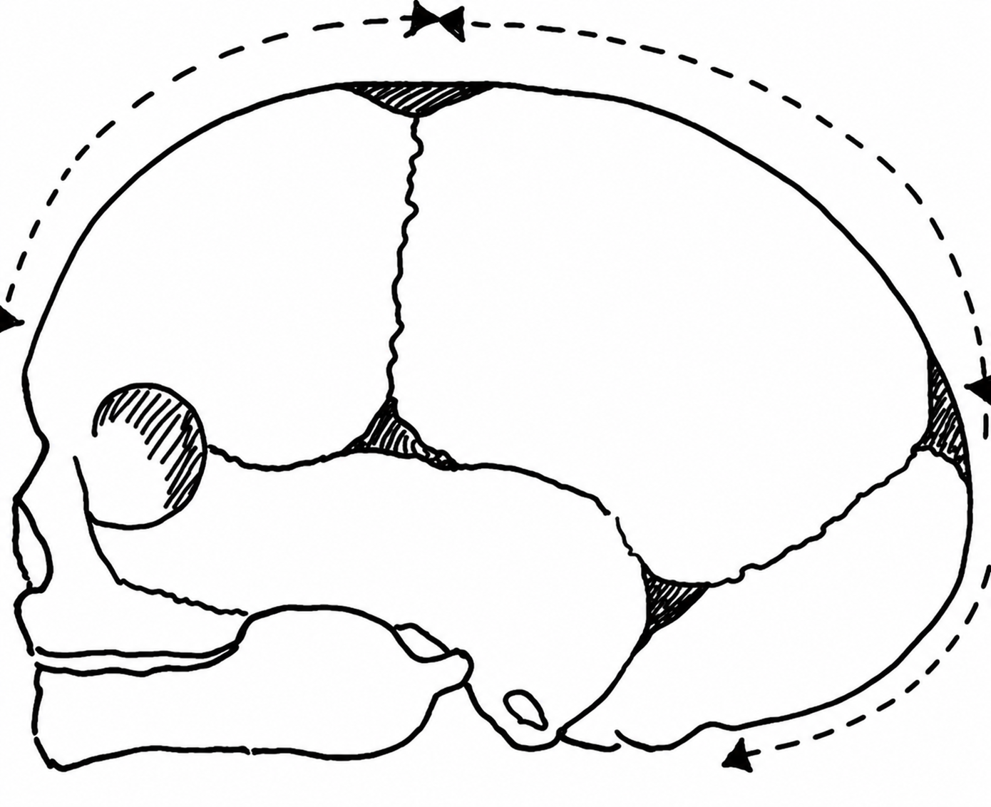 <p>spot at the top </p>