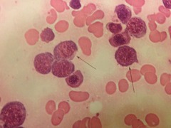 <p>10-15 um. N:C ratio 4:1. Cytoplasm is polychromatophilic due to hemoglobin production. Chromatin is clumped with distinct areas of parachromatin. Last stage to divide. Normally confined to bone marrow.</p>
