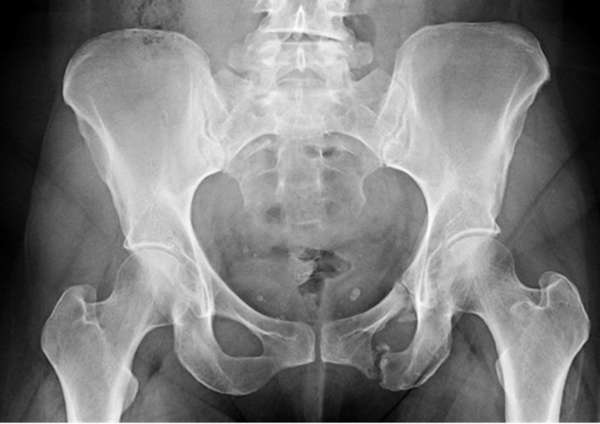 <p>What is the diagnosis?</p>
