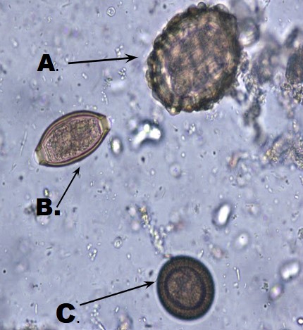 <p>Name of A, B, and C</p>