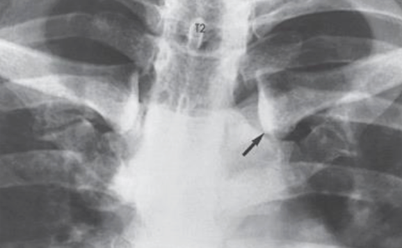 <p>anatomy, projection, position</p>