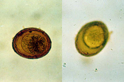 <p></p><ul><li><p>surface is smoother and the central mass doesn’t fill all of the space in the shell as compared to Toxocara</p></li><li><p>same color as Toxocara when unstained</p></li></ul><p></p>