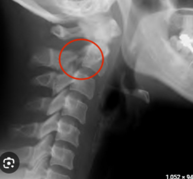 <p>what is the diagnosis?</p>