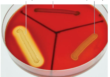 <p>What type of media is Blood agar? </p>