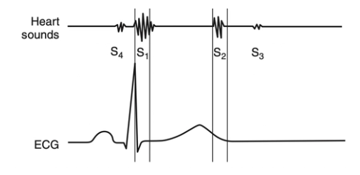 <p><strong>Gallop</strong> = Low frequency heart sounds during diastole</p><p><strong>S3</strong> = Ventricular gallop associated with rapid passive ventricular filling in early diastole</p><ul><li><p><u>DDx:</u> NOT normal (indicates DCM)</p></li></ul><p><strong>S4</strong> = Atrial contraction in late diastole</p><ul><li><p><u>DDx:</u> Increased ventricular stiffness and hypertrophy</p><ol><li><p>HCM</p></li><li><p>Anaemia</p></li><li><p>Hyperthyroidism</p></li></ol></li></ul><p></p>