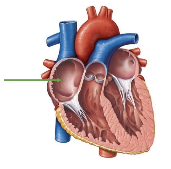 term image