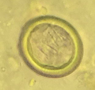 <p>What is this</p>