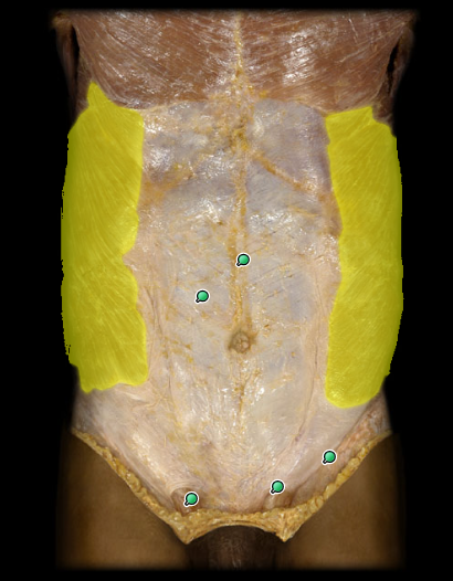 <p>action: this muscle supports viscera (i.e., internal abdominal organs), stabilizes the vertebral column, and maintains posture. its unilateral action (i.e., action of one oblique) is contralateral rotation of the waist. its bilateral action is flexion of the trunk</p>