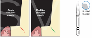 <p>sveder z ravnim vrhom</p>