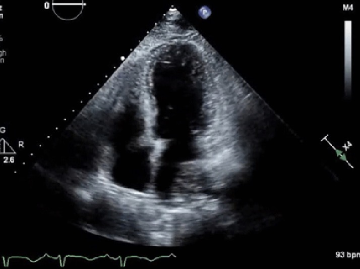<p>Octopus Pot pathology</p>