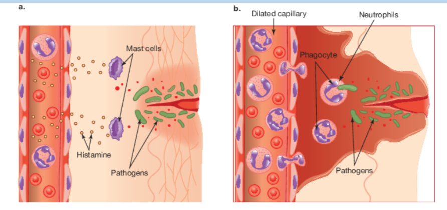 <p>Stages of Inflammation (expand/elaborate)</p>