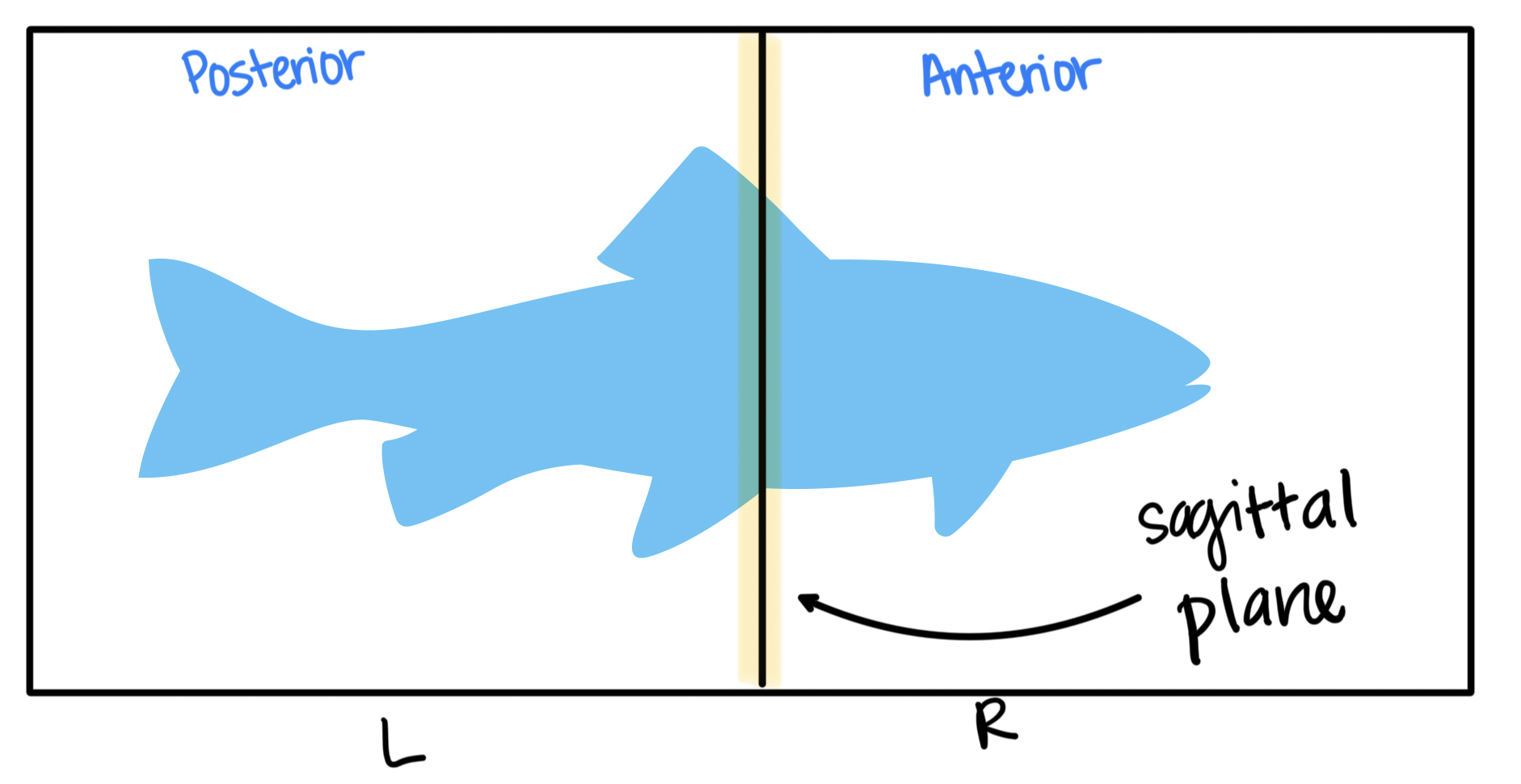 <p>splits into a left or right (anterior or posterior)</p>