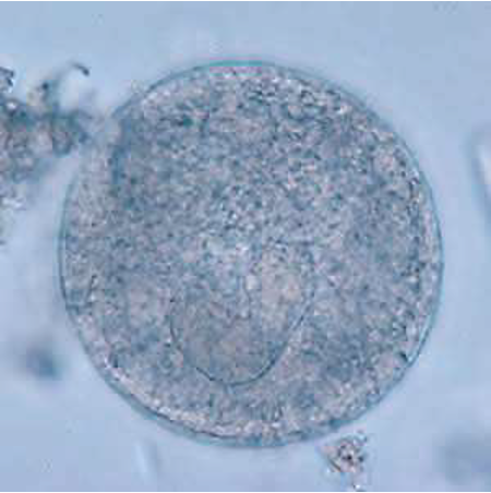 <p><span>65&nbsp;<strong>µm</strong></span></p>