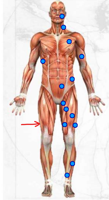 <p>outside muscle on the upper leg area </p>