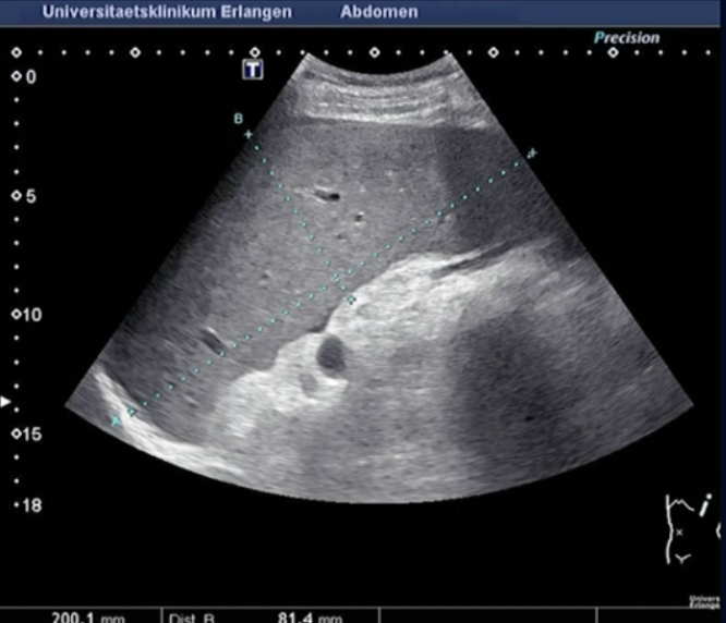 <p>Path? (hint… SPLEEN)</p>