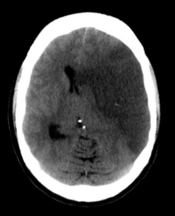 <p>what is the diagnosis?</p>