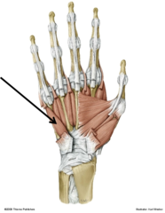 <p>Opponens Digiti Minimi</p>