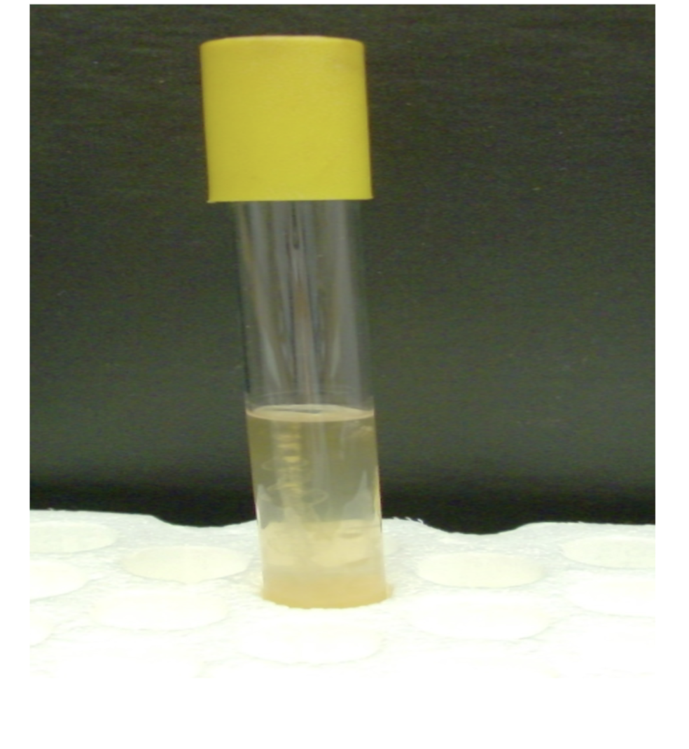 <p>what is the test and result?</p>