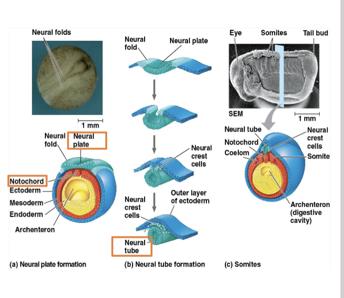 <p><span>• </span><span style="color: purple;"><strong>Neurulation</strong></span><span>-formation of the<br>brain and spinal cord in vertebrates<br>• Mesoderm cells form </span><span style="color: purple;"><strong>notochord</strong></span><span><br>• Notochord secretes signaling<br>molecules causing ectoderm to<br>form </span><span style="color: purple;"><strong>neural plate</strong></span><span><br>• Neural plate cells change shape<br>to form the </span><span style="color: purple;"><strong>neural tube</strong></span><span> which<br>becomes the </span><span style="color: purple;"><strong>central nervous<br>system (brain and spinal cord)</strong></span><span><br>• Notochord disappears before<br>birth, but some parts persist as<br>disks</span></p>