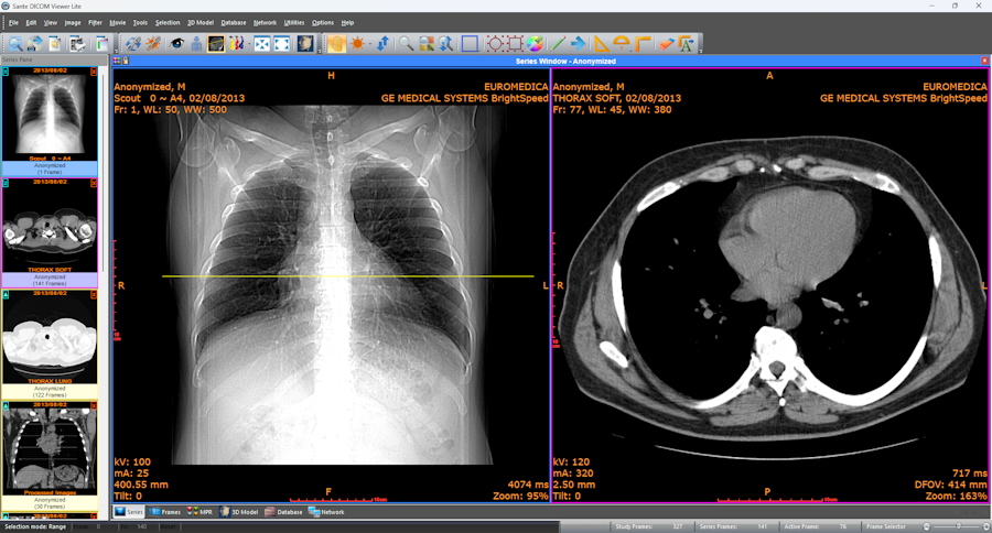 <p>is the standard used to store, share, and display medical images.</p>
