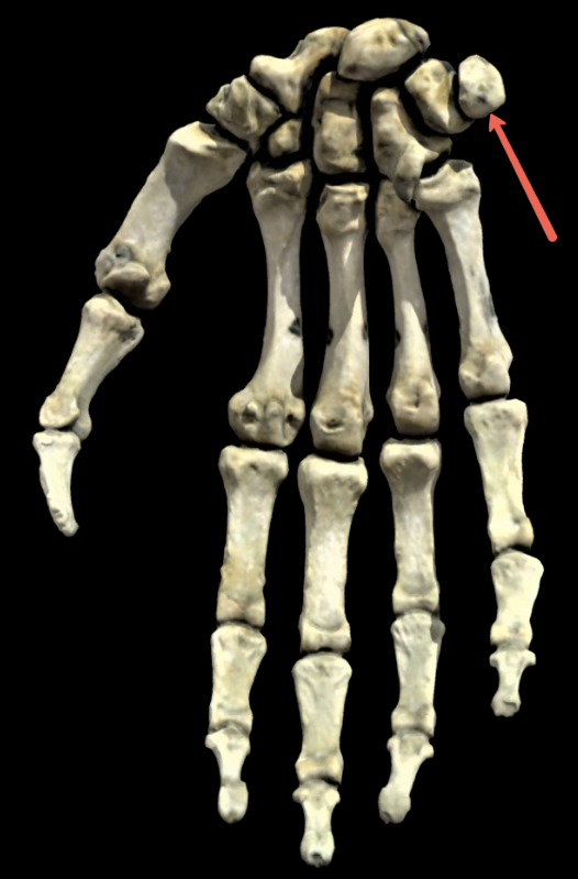 <p><span><strong>Identify the bone marking indicated by the pointer.</strong></span></p>