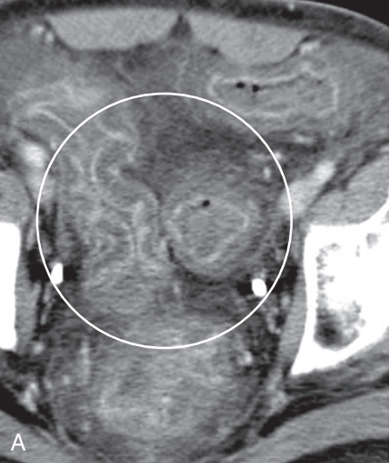 <p>diagnosis</p>