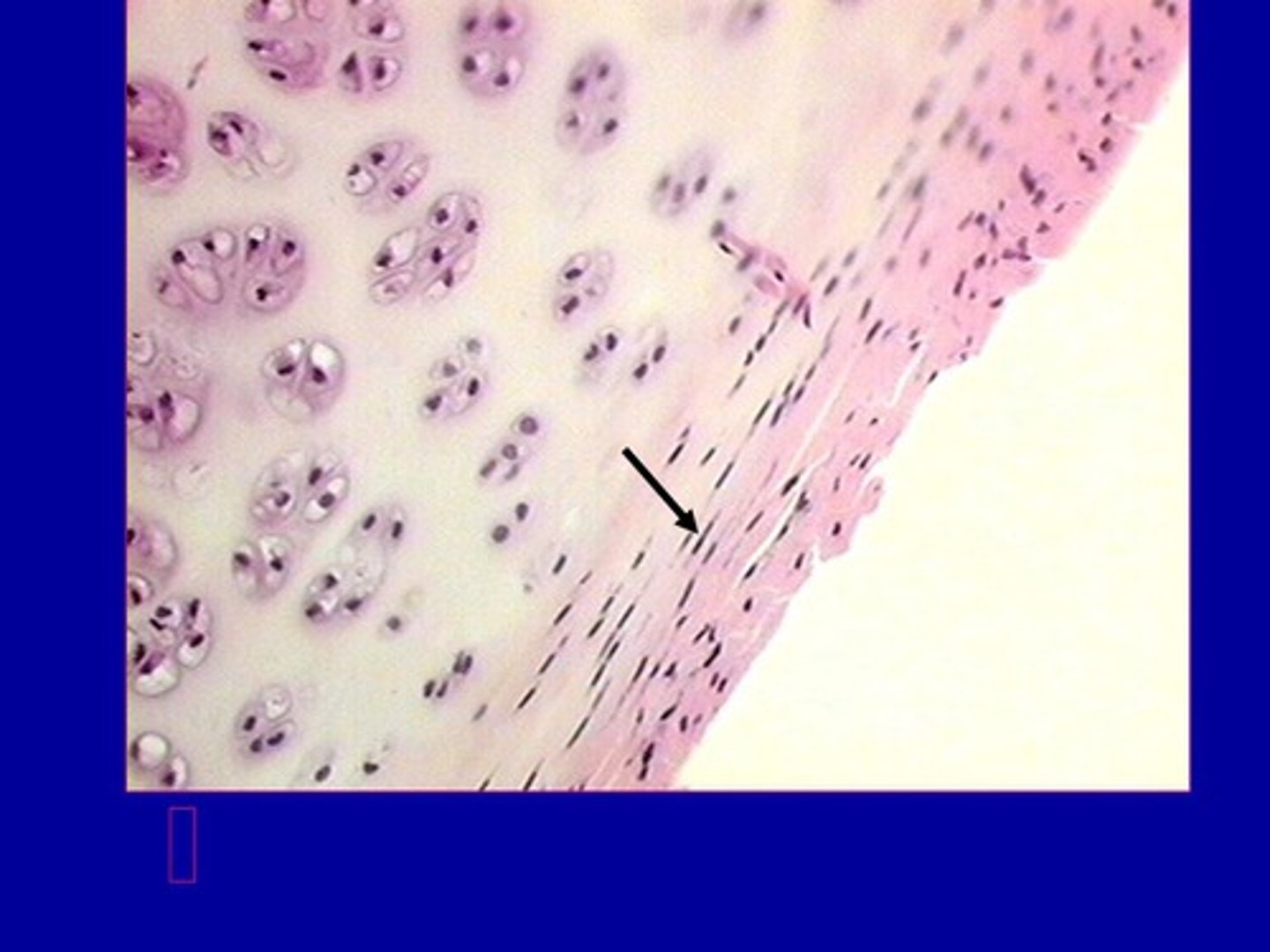 <p>Cartilage‑forming cells that produce matrix.</p>
