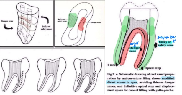 <p>by Abou-Rass, Frank, and Glick.</p><p>to <span style="color: red;">file away from the inner curve</span> of a root to <span style="color: red;">reduce the risk of strip perforation</span></p><p>technique in <strong>multirooted teeth: </strong>filing is concentrated on the<span style="color: red;"> bulky or safety zone </span>using a push-and-pull motion, away from the danger zone.</p><ul><li><p><span style="color: red;">danger zone:</span> always the inner surface of the tooth.</p></li><li><p><span style="color: red;">safety zone </span>reference:</p><ul><li><p>if distal root, safety zone = mesial.</p></li><li><p>if mesial root, safety zone = distal.</p></li></ul></li></ul><p></p>
