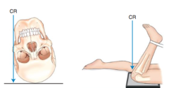 <p>Skimming a body part to project it in profile.</p>