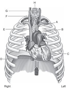 <p>G</p>