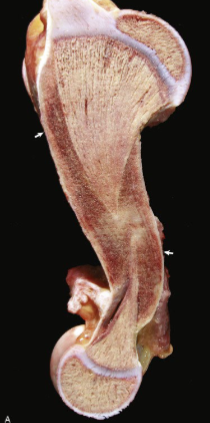 <p>What is this bone showing?</p>
