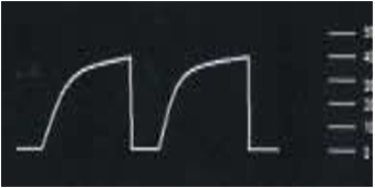 <p>What is this ETCO2 waveform</p>