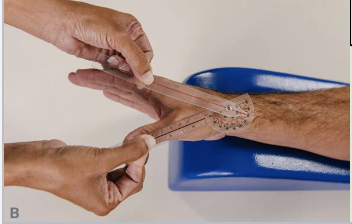 <p>Palmar Abduction/adduction Typical Range of Motion</p>