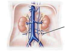 <p>Identify the structure</p>
