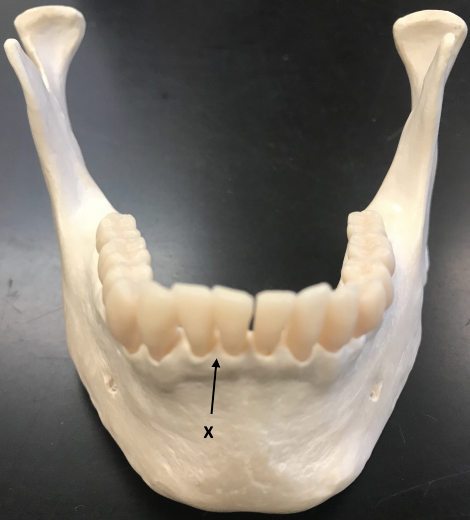 <p><span>Identify the structure labeled "X"</span></p>
