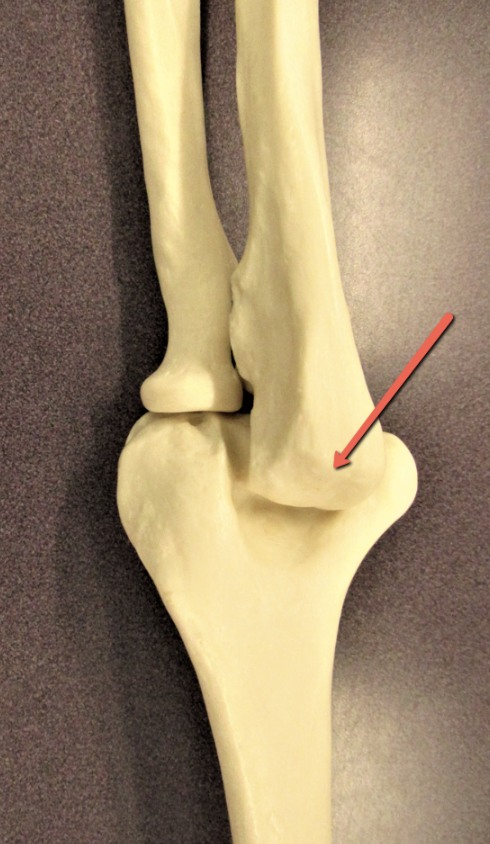 <p><span><strong>Identify the bone marking indicated by the pointer.</strong></span></p>