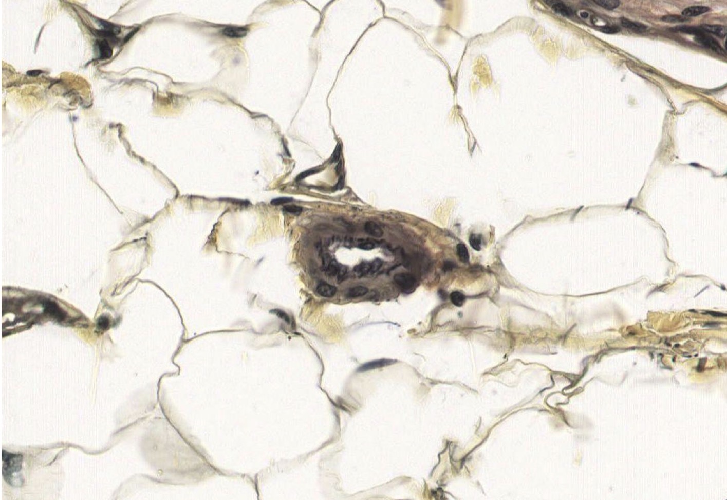 <p>Identify the Vessel and the Layer pictured</p>