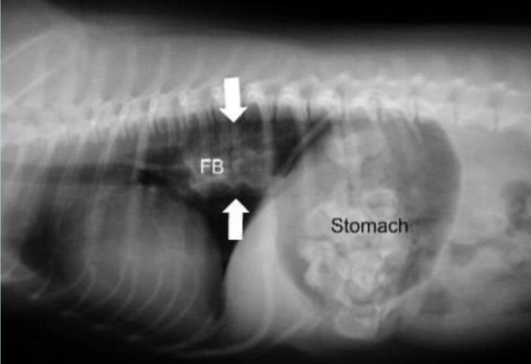 <p>Esophageal Obstruction</p>
