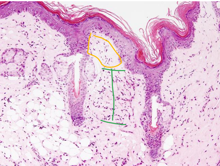 <p>Identify the two layers?</p>