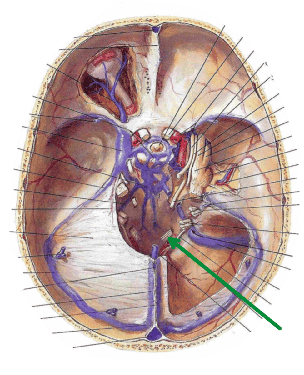 <p>Identify the structure indicated by the arrow</p>
